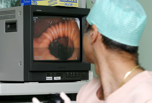What can be expected during a colonoscopy
